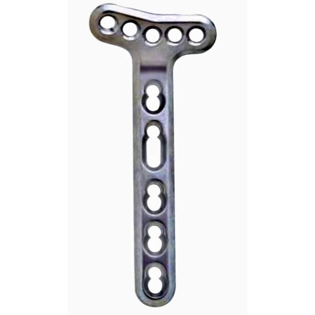 BONE LOCK VOLAR EXTRA-ARTICULAR T-PLATE 5 HEAD HOLE   FOR 2.4/2.7 MM SCREW